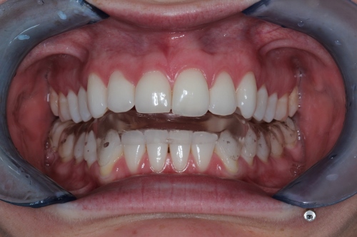Zahnarzt Dr. Brietze: Kiefergelenksprechstunde