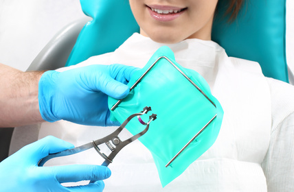 Zahnarzt Dr. Brietze: Leistungen Kofferdam-Behandlung